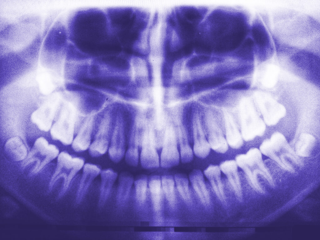 Radiographie