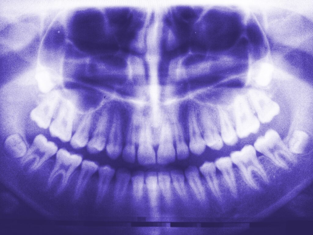 Dr Solène Vo Quang - Spécialiste en chirurgie maxillo-faciale